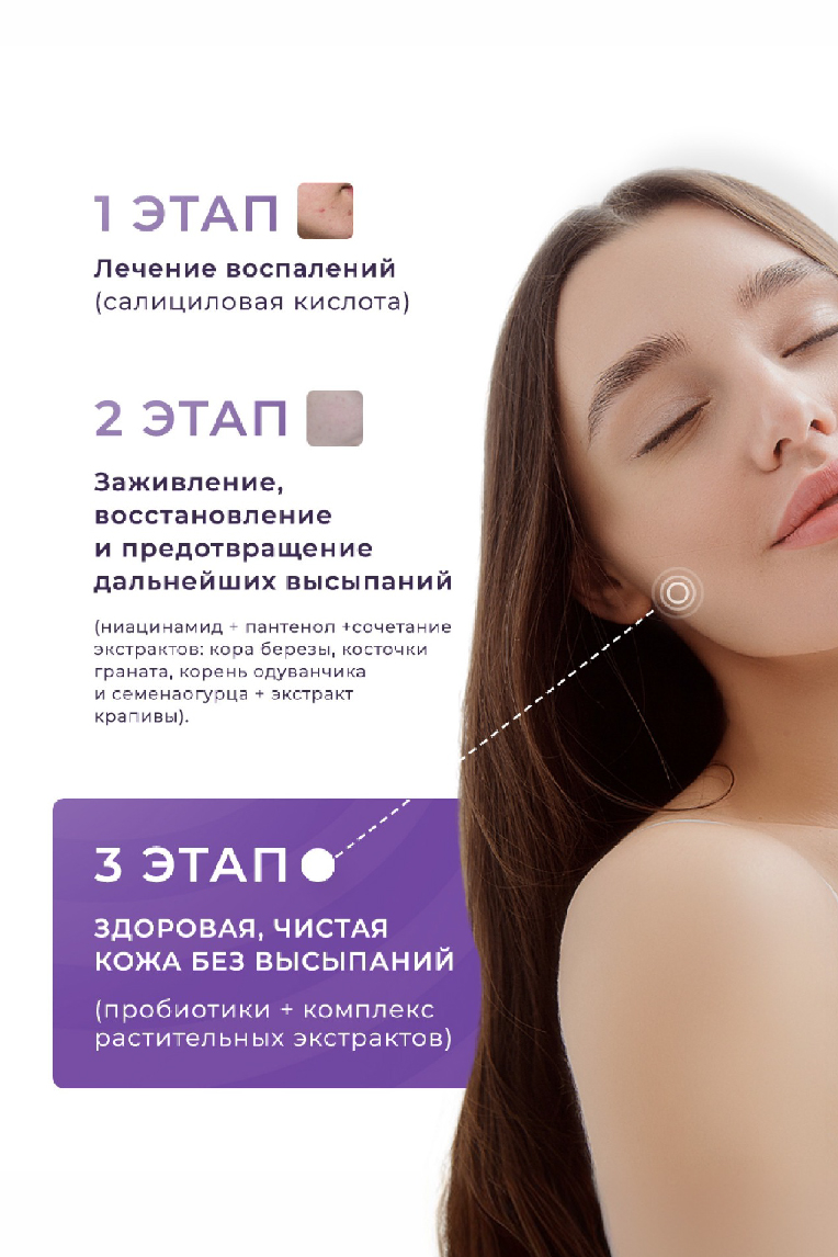 Сыворотка для лица VIA LABOTE АНТИ-АКНЕ, 50 мл