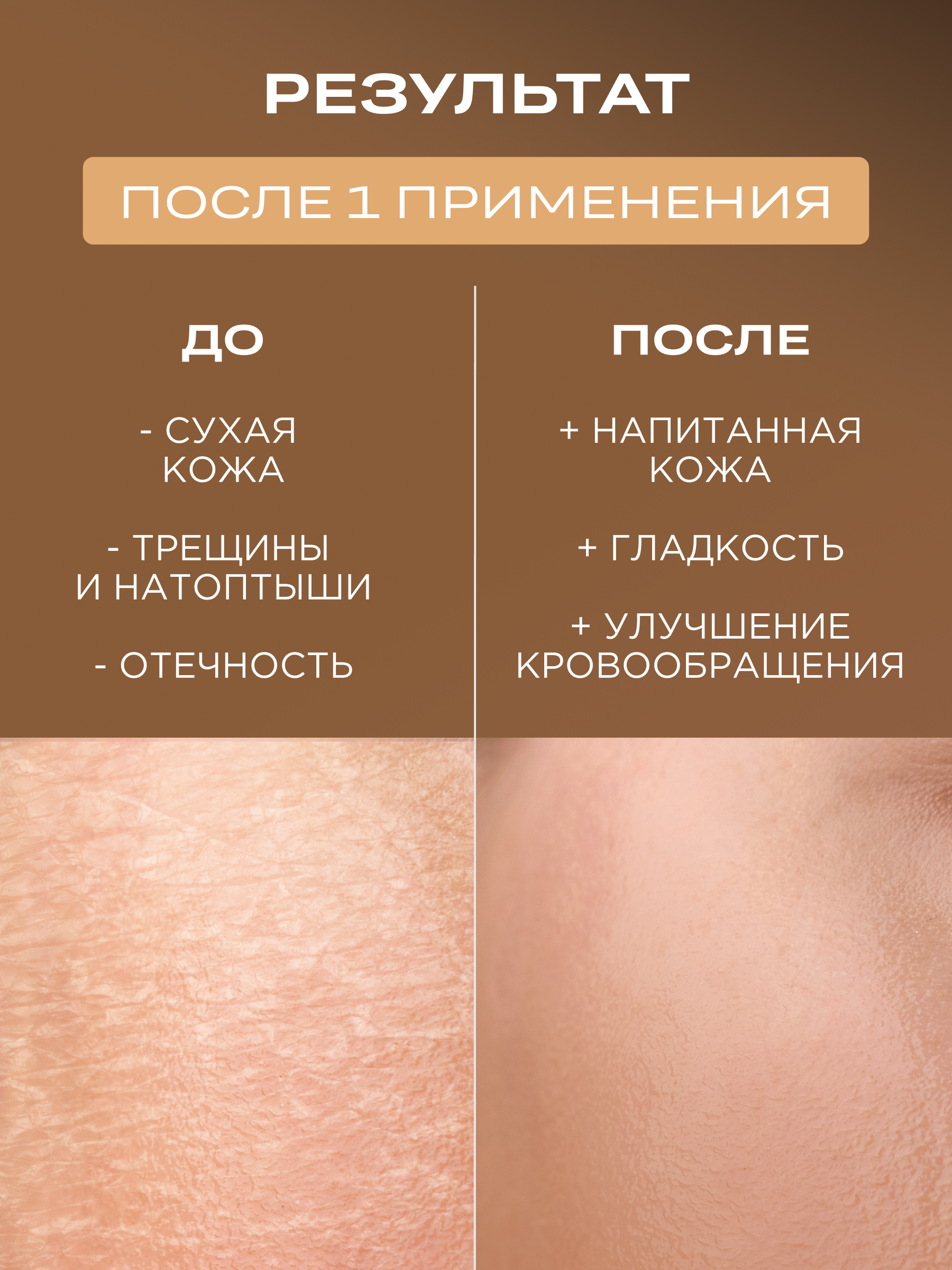 Крем для ног увлажняющий питательный от трещин и сухости с мочевиной, HELDI, 300 мл