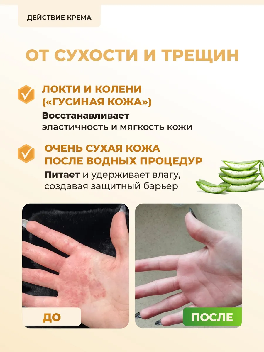 Крем Акрустал Медовая Формула 65 мл для ухода за кожей при сухости, обветривании, аллергии, зуде, шелушении, огрубении кожи